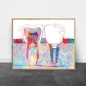 Dental Art Picture Tooth Implant Canvas Print Dentist Wall Art Painting Medicine Hygienist Poster Tooth Watercolor Clinic Decor